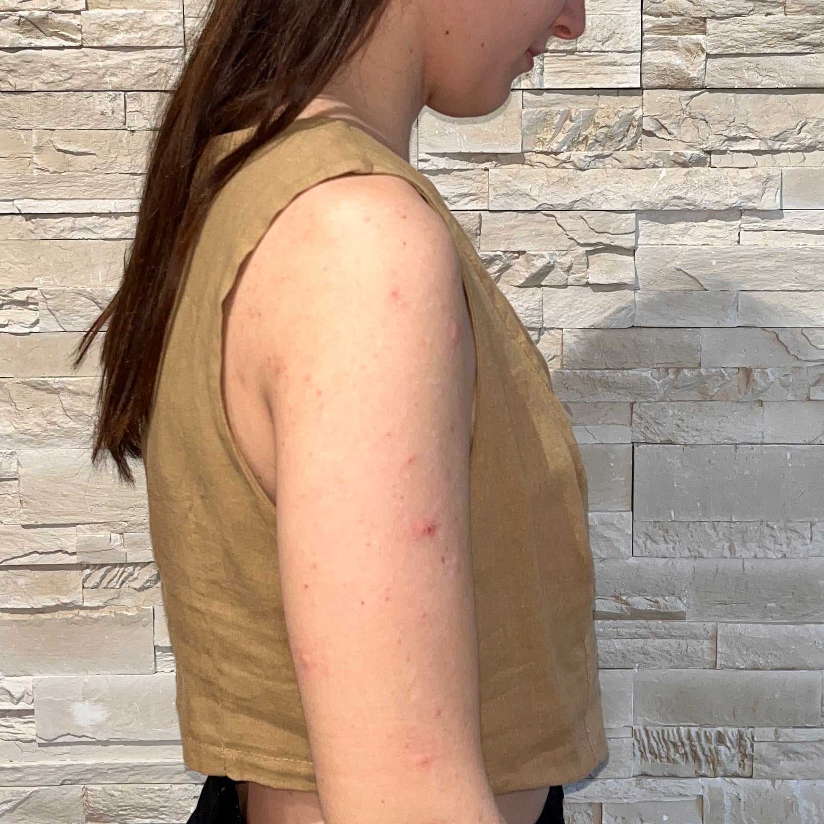 Gilet in lino